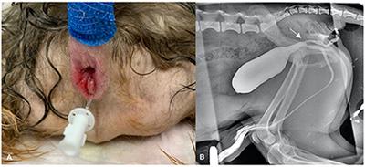 Case report: Post-surgical complication in a case of urethral duplication in a dog